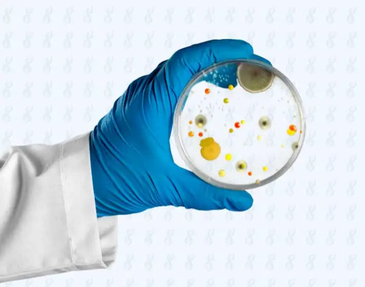 Hand in Gummihandschuh hält Petrischale mit Bakterien hoch